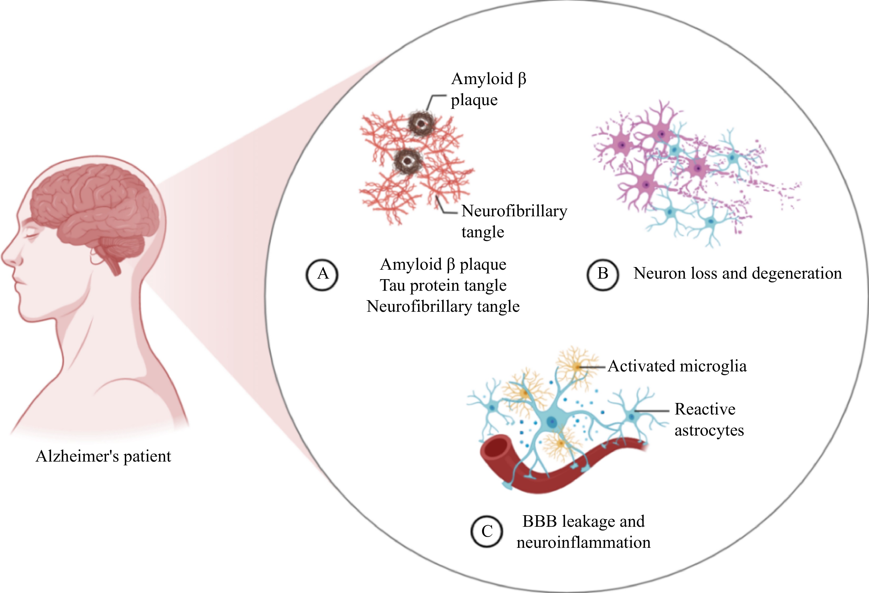 Beta Amyloid Protein Amyloid Plaque And Tau Protein Aggregate