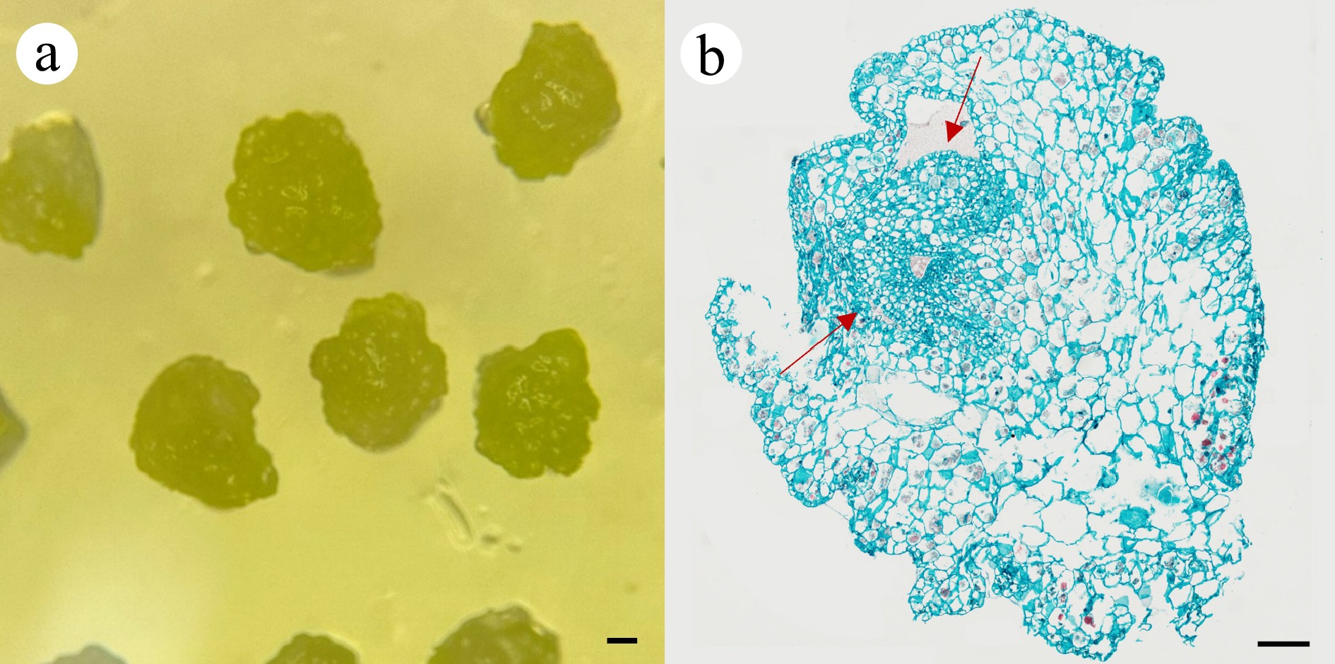 The establishment of a micropropagation system for