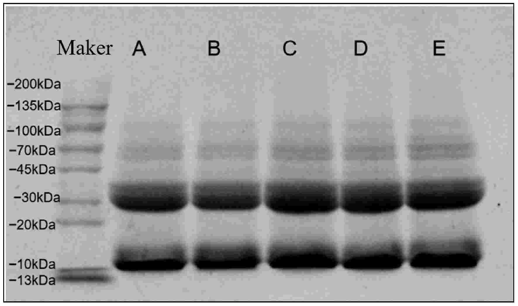 Effects of heat and ultrasonic treatments on the structure and processing  characteristics of walnut protein