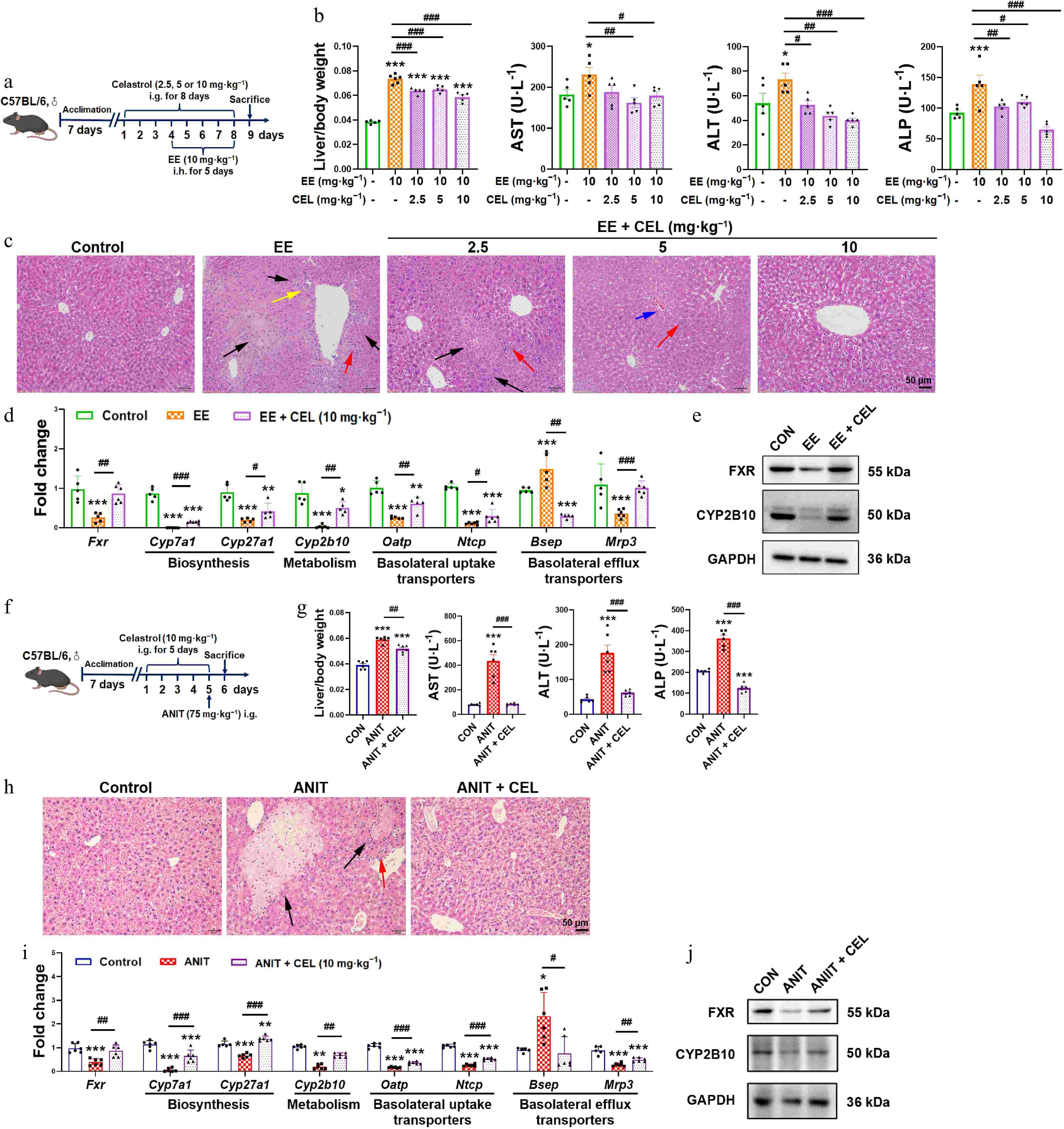 Celastrol ameliorates cholestatic liver injury by promoting a