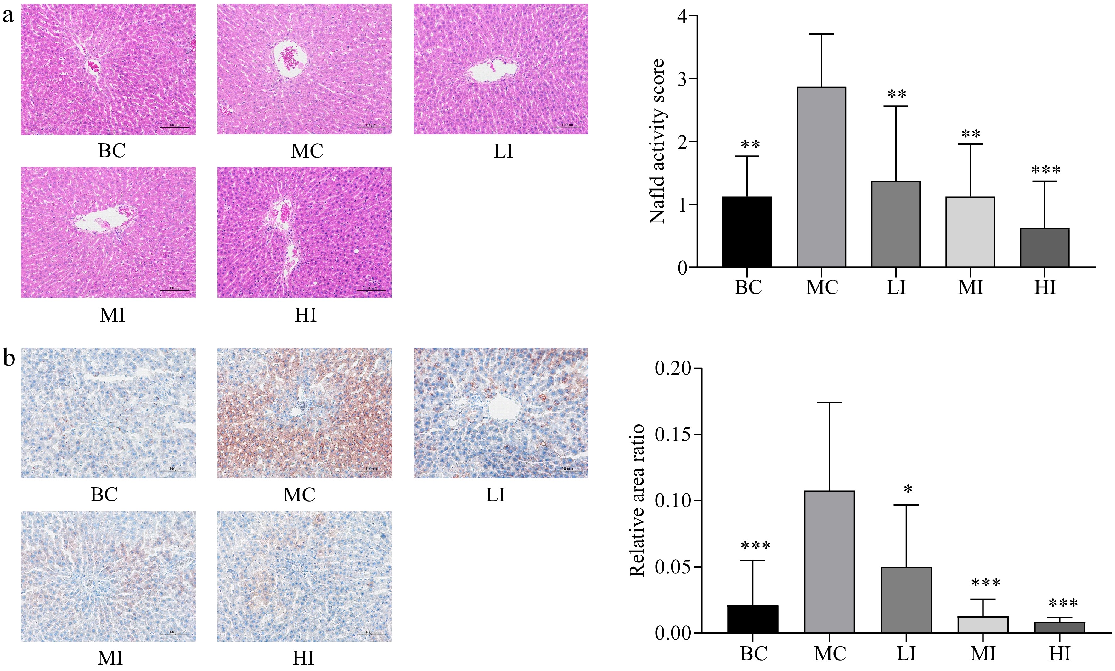 Anti-obesity and hypolipidemic effects of 