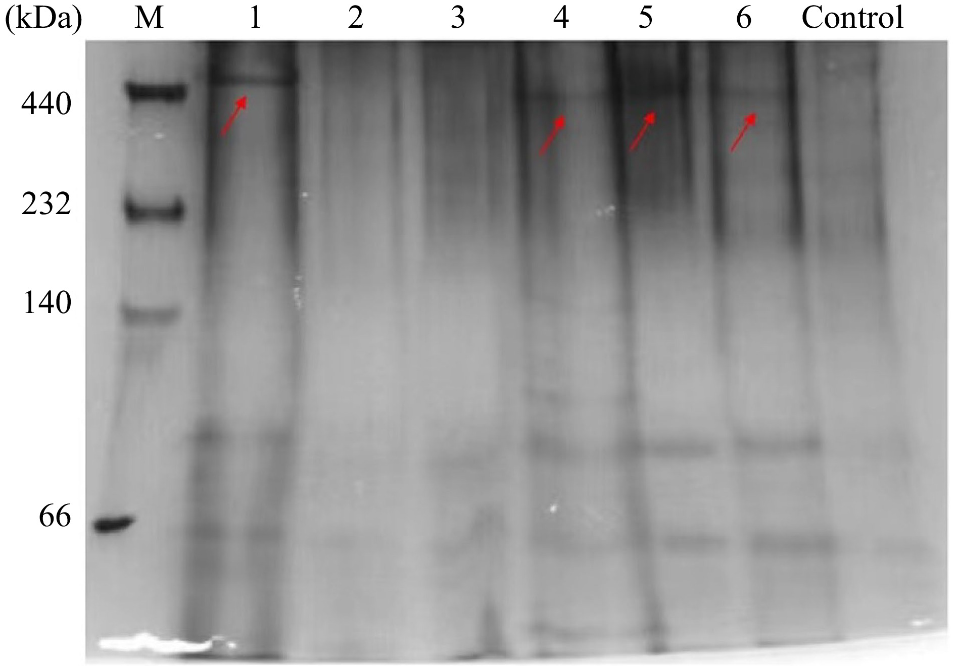 Effects of heat treatment on the structure, digestive property, and