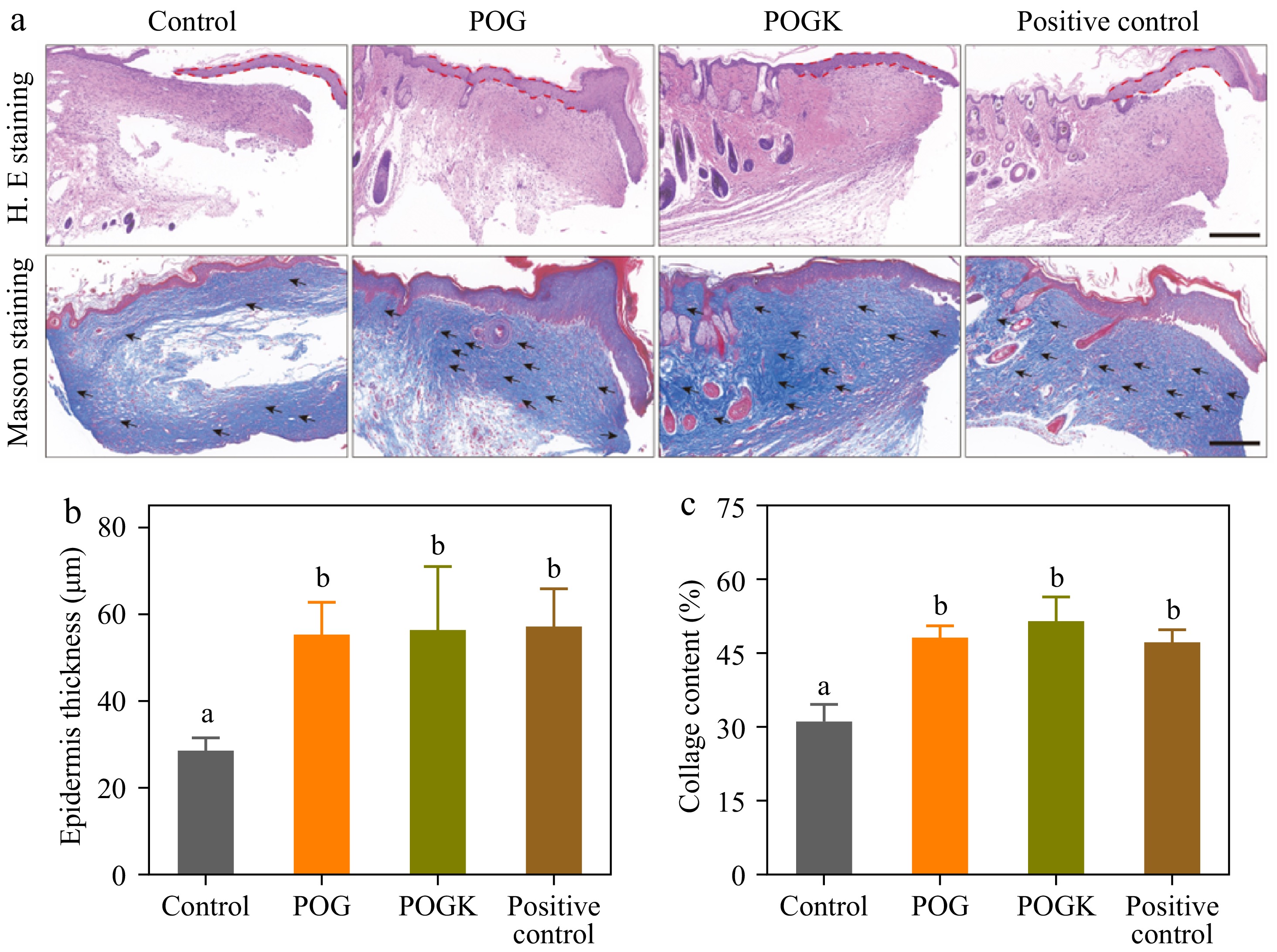 Wound Staining pH/glucose dual-responsive protein-based hydrogels with enhanced ...