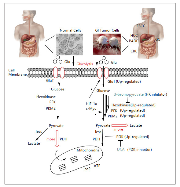 The Potential Role of Changes in the Glucose and Lipid Metabolic ...